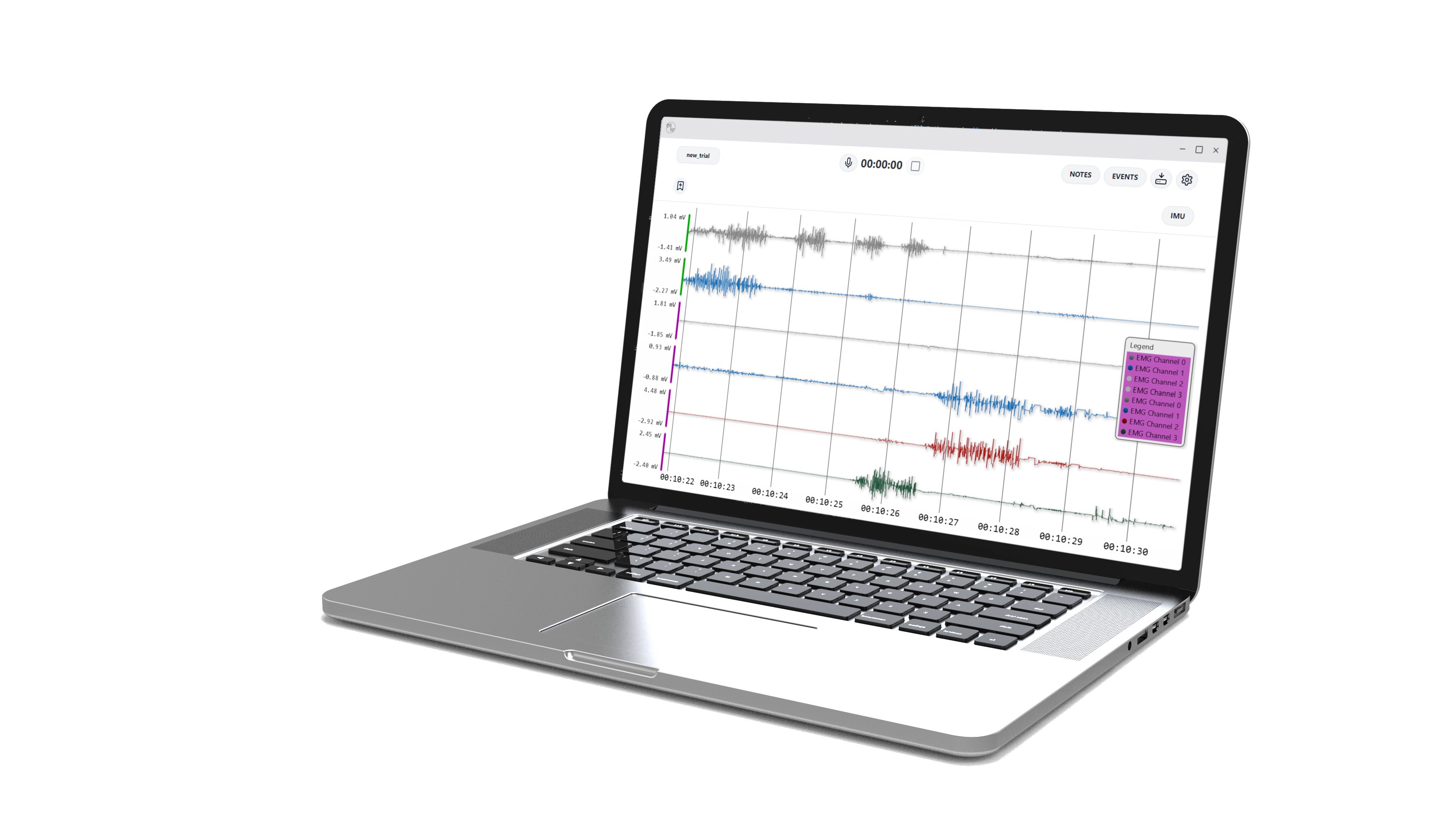 Event flagging workflow preview on screen